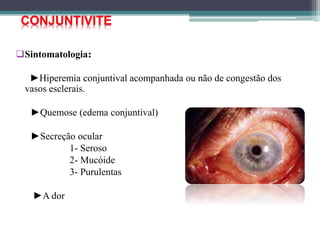 Sintomatologia:
►Hiperemia conjuntival acompanhada ou não de congestão dos
vasos esclerais.
►Quemose (edema conjuntival)
►Secreção ocular
1- Seroso
2- Mucóide
3- Purulentas
►A dor
CONJUNTIVITE
 