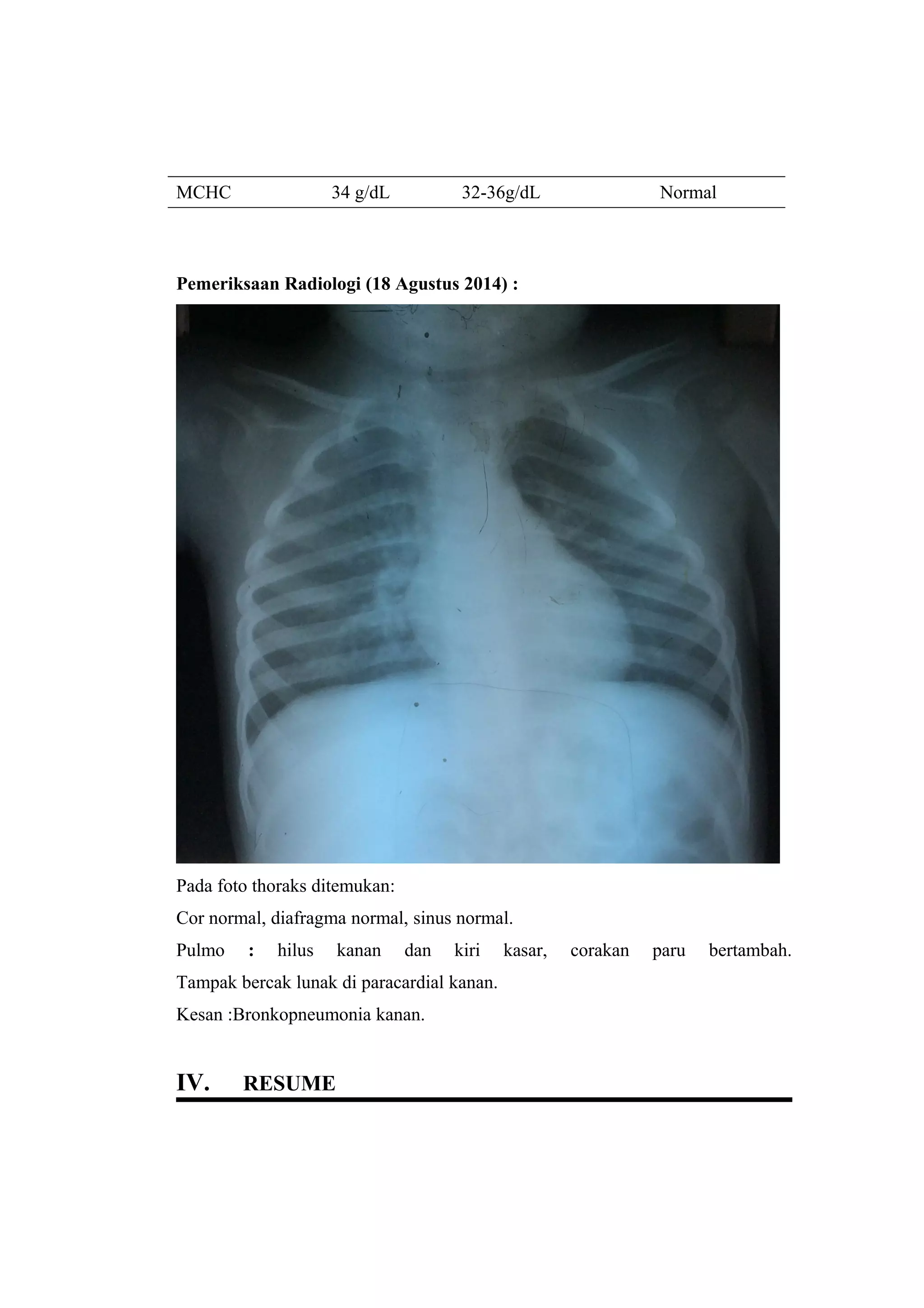 MCHC 34 g/dL 32-36g/dL Normal
Pemeriksaan Radiologi (18 Agustus 2014) :
Pada foto thoraks ditemukan:
Cor normal, diafragma normal, sinus normal.
Pulmo : hilus kanan dan kiri kasar, corakan paru bertambah.
Tampak bercak lunak di paracardial kanan.
Kesan :Bronkopneumonia kanan.
IV. RESUME
 