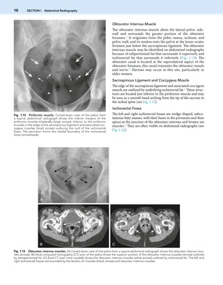 Textbook Of Gastrointestinal Radiology 5th Edition 5th Richard M Gore | PDF
