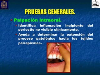 PRUEBAS GENERALES.
Palpación intraoral.
 Identifica inflamación incipiente del
 periostio no visible clínicamente.
 Ayuda a determinar la extensión del
 proceso patológico hacia los tejidos
 periapicales.
 