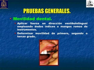 PRUEBAS GENERALES.
Movilidad dental.
 Aplicar fuerza en dirección vestíbulolingual
 empleando dedos índices o mangos romos de
 instrumentos.
 Determinar movilidad de primero, segundo o
 tercer grado.
 