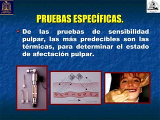 PRUEBAS ESPECÍFICAS.
De las pruebas de sensibilidad
pulpar, las más predecibles son las
térmicas, para determinar el estado
de afectación pulpar.
 