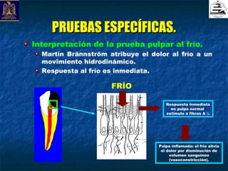 PRUEBAS ESPECÍFICAS.
Interpretación de la prueba pulpar al frío.
  Martín Brännström atribuye el dolor al frío a un
  movimiento hidrodinámico.
  Respuesta al frío es inmediata.

                     FRÍO

                                     Respuesta inmediata
                                       en pulpa normal
                                     estímulo a fibras A δ.




                                  Pulpa inflamada: el frío alivia
                                   el dolor por disminución de
                                       volumen sanguíneo
                                       (vasoconstricción).
 