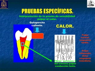 PRUEBAS ESPECÍFICAS.
Interpretación de la prueba de sensibilidad
               pulpar al calor.
        Gutapercha
          caliente.
                            CALOR.
                                                   Pulpa
                                                 normal:
                                                respuesta
                                                  tardía.


                                                   Pulpa
                                                inflamada:
                                                   dolor
                                                 respuesta
                           Fibras nerviosas C   inmediata.
                           del estroma pulpar
                           conducción lenta.
 