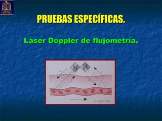 PRUEBAS ESPECÍFICAS.

Láser Doppler de flujometría.
 