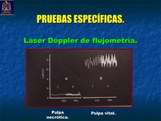 PRUEBAS ESPECÍFICAS.

Láser Doppler de flujometría.




       Pulpa      Pulpa vital.
     necrótica.
 