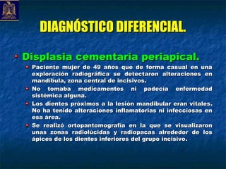 DIAGNÓSTICO DIFERENCIAL.

Displasia cementaria periapical.
 Paciente mujer de 49 años que de forma casual en una
 exploración radiográfica se detect aron alteraciones en
 mandíbula, zona central de incisivos. 
 No tomaba medicamentos ni padecía enfermedad
 sistémica alguna. 
 Los dientes próximos a la lesión mandibular eran vitales .
 No ha tenido alteraciones inflamatorias ni infecciosas en
 esa área. 
 Se realizó ortopantomografía en la que se visualizaron
 unas zonas radiolúcidas y radiopacas alrededor de los
 ápices de los dientes inferiores del grupo incisivo .
 