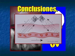 Conclusiones.
 