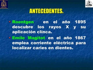 ANTECEDENTES.
Roentgen       en el año 1895
descubre los rayos X y su
aplicación clínca.
Emile Magitot en el año 1867
emplea corriente eléctrica para
localizar caries en dientes.
 