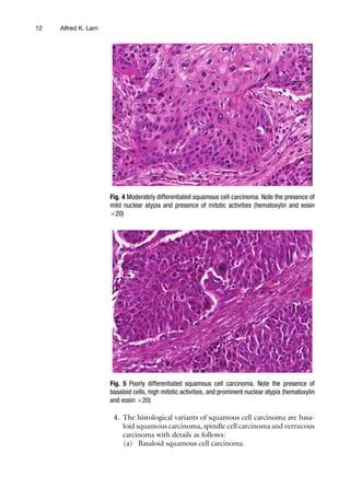 Esophageal Squamous Cell Carcinoma Methods And Protocols 1st Alfred K ...