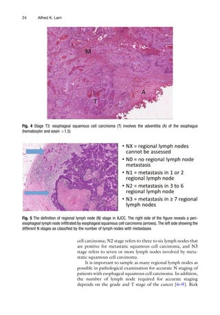 Esophageal Squamous Cell Carcinoma Methods And Protocols 1st Alfred K ...