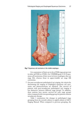 Esophageal Squamous Cell Carcinoma Methods And Protocols 1st Alfred K ...