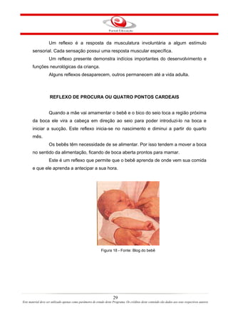 Um reflexo é a resposta da musculatura involuntária a algum estímulo
       sensorial. Cada sensação possui uma resposta muscular específica.
                    Um reflexo presente demonstra indícios importantes do desenvolvimento e
       funções neurológicas da criança.
                    Alguns reflexos desaparecem, outros permanecem até a vida adulta.



                     REFLEXO DE PROCURA OU QUATRO PONTOS CARDEAIS


                    Quando a mãe vai amamentar o bebê e o bico do seio toca a região próxima
       da boca ele vira a cabeça em direção ao seio para poder introduzi-lo na boca e
       iniciar a sucção. Este reflexo inicia-se no nascimento e diminui a partir do quarto
       mês.
                    Os bebês têm necessidade de se alimentar. Por isso tendem a mover a boca
       no sentido da alimentação, ficando de boca aberta prontos para mamar.
                    Este é um reflexo que permite que o bebê aprenda de onde vem sua comida
       e que ele aprenda a antecipar a sua hora.




                                                             Figura 18 - Fonte: Blog do bebê




                                                                       29
Este material deve ser utilizado apenas como parâmetro de estudo deste Programa. Os créditos deste conteúdo são dados aos seus respectivos autores
 