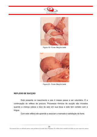 Figura 19 - Fonte: Blog do bebê




                                                             Figura 20 - Fonte: Blog do bebê




       REFLEXO DE SUCÇÃO


                    Está presente no nascimento e aos 4 meses passa a ser voluntário. É a
       continuação do reflexo de procura. Processos rítmicos de sucção são iniciados
       quando a criança coloca o bico do seio em sua boca e este tem contato com a
       língua.
                    Com este reflexo ele aprende a associar a mamada à satisfação da fome.




                                                                       30
Este material deve ser utilizado apenas como parâmetro de estudo deste Programa. Os créditos deste conteúdo são dados aos seus respectivos autores
 