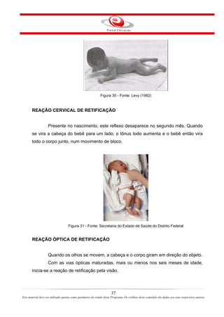 Figura 30 - Fonte: Levy (1982)


       REAÇÃO CERVICAL DE RETIFICAÇÃO


                    Presente no nascimento, este reflexo desaparece no segundo mês. Quando
       se vira a cabeça do bebê para um lado, o tônus todo aumenta e o bebê então vira
       todo o corpo junto, num movimento de bloco.




                                    Figura 31 - Fonte: Secretaria do Estado de Saúde do Distrito Federal


       REAÇÃO ÓPTICA DE RETIFICAÇÃO


                    Quando os olhos se movem, a cabeça e o corpo giram em direção do objeto.
                    Com as vias ópticas maturadas, mais ou menos nos seis meses de idade,
       inicia-se a reação de retificação pela visão.



                                                                       37
Este material deve ser utilizado apenas como parâmetro de estudo deste Programa. Os créditos deste conteúdo são dados aos seus respectivos autores
 