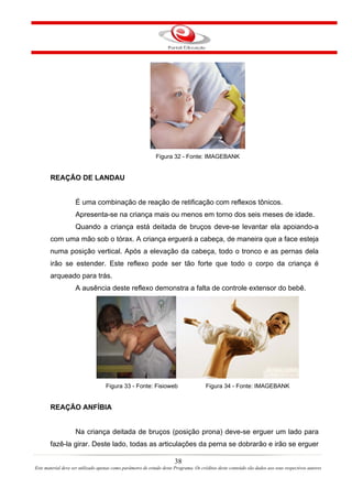 Figura 32 - Fonte: IMAGEBANK


       REAÇÃO DE LANDAU


                    É uma combinação de reação de retificação com reflexos tônicos.
                    Apresenta-se na criança mais ou menos em torno dos seis meses de idade.
                    Quando a criança está deitada de bruços deve-se levantar ela apoiando-a
       com uma mão sob o tórax. A criança erguerá a cabeça, de maneira que a face esteja
       numa posição vertical. Após a elevação da cabeça, todo o tronco e as pernas dela
       irão se estender. Este reflexo pode ser tão forte que todo o corpo da criança é
       arqueado para trás.
                    A ausência deste reflexo demonstra a falta de controle extensor do bebê.




                                    Figura 33 - Fonte: Fisioweb                        Figura 34 - Fonte: IMAGEBANK


       REAÇÃO ANFÍBIA


                    Na criança deitada de bruços (posição prona) deve-se erguer um lado para
       fazê-la girar. Deste lado, todas as articulações da perna se dobrarão e irão se erguer

                                                                       38
Este material deve ser utilizado apenas como parâmetro de estudo deste Programa. Os créditos deste conteúdo são dados aos seus respectivos autores
 