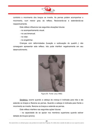 contrário o movimento dos braços se inverte. As pernas podem acompanhar o
       movimento, num menor grau do reflexo, flexionando-se e estendendo-se
       respectivamente.
                    Este reflexo influencia nas seguintes situações futuras:
                     - no acompanhamento visual;
                     - no uso bimanual;
                     - no rolar;
                     - no engatinhar.
                    Crianças com deformidades (luxação e subluxação do quadril...) não
       conseguem apresentar este reflexo. Isto pode interferir negativamente em seu
       desenvolvimento.




                                                              Figura 36 - Fonte: Levy (1982)


                    Simétrico: ocorre quando a cabeça da criança é inclinada para trás e ela
       estende os braços e flexiona as pernas. Quando a cabeça é inclinada para frente o
       movimento se inverte, flexiona os braços e estende as pernas.
                    Este reflexo interfere nas seguintes ações futuras:
                     - na capacidade de se apoiar nos membros superiores quando estiver
       deitado de bruços (prono);

                                                                       40
Este material deve ser utilizado apenas como parâmetro de estudo deste Programa. Os créditos deste conteúdo são dados aos seus respectivos autores
 