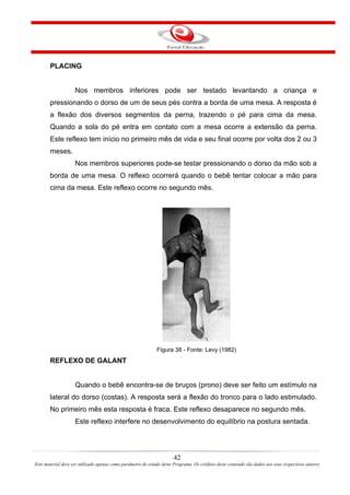 PLACING


                    Nos membros inferiores pode ser testado levantando a criança e
       pressionando o dorso de um de seus pés contra a borda de uma mesa. A resposta é
       a flexão dos diversos segmentos da perna, trazendo o pé para cima da mesa.
       Quando a sola do pé entra em contato com a mesa ocorre a extensão da perna.
       Este reflexo tem início no primeiro mês de vida e seu final ocorre por volta dos 2 ou 3
       meses.
                    Nos membros superiores pode-se testar pressionando o dorso da mão sob a
       borda de uma mesa. O reflexo ocorrerá quando o bebê tentar colocar a mão para
       cima da mesa. Este reflexo ocorre no segundo mês.




                                                              Figura 38 - Fonte: Levy (1982)
       REFLEXO DE GALANT


                    Quando o bebê encontra-se de bruços (prono) deve ser feito um estímulo na
       lateral do dorso (costas). A resposta será a flexão do tronco para o lado estimulado.
       No primeiro mês esta resposta é fraca. Este reflexo desaparece no segundo mês.
                    Este reflexo interfere no desenvolvimento do equilíbrio na postura sentada.




                                                                       42
Este material deve ser utilizado apenas como parâmetro de estudo deste Programa. Os créditos deste conteúdo são dados aos seus respectivos autores
 