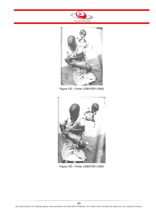 Figura 102 – Fonte: LEBOYER (1995)




                                                  Figura 103 – Fonte: LEBOYER (1995)




                                                                       89
Este material deve ser utilizado apenas como parâmetro de estudo deste Programa. Os créditos deste conteúdo são dados aos seus respectivos autores
 
