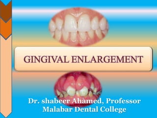 GINGIVAL ENLARGEMENT
Dr. shabeer Ahamed, Professor
Malabar Dental College
 