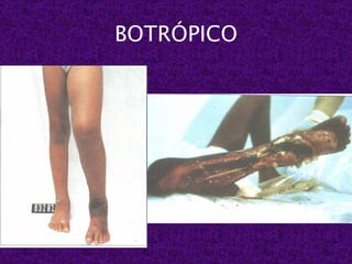 BOTRÓPICO
 