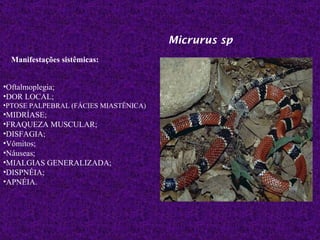 Micrurus sp
  Manifestações sistêmicas:


•Oftalmoplegia;
•DOR LOCAL;
•PTOSE PALPEBRAL (FÁCIES MIASTÊNICA)
•MIDRÍASE;
•FRAQUEZA MUSCULAR;
•DISFAGIA;
•Vômitos;
•Náuseas;
•MIALGIAS GENERALIZADA;
•DISPNÉIA;
•APNÉIA.
 