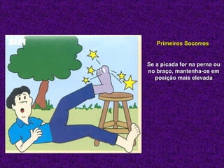 Primeiros Socorros


Se a picada for na perna ou
no braço, mantenha-os em
   posição mais elevada
 