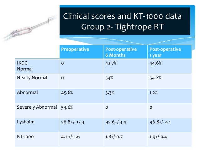 Tunnel Enlargement In Single Bundle Acl Reconstruction Using Bio Inte