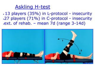 Askling H-test 
• 13 players (35%) in L-protocol - insecurity 
•27 players (71%) in C-protocol - insecurity 
•ext. of rehab. – mean 7d (range 3-14d) 
Askling Aest kalli.n 2g0 2120 14 
 