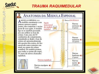 TRAUMA RAQUIMEDULAR
 