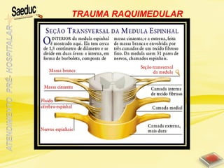 TRAUMA RAQUIMEDULAR
 