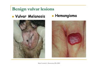 assessment of the female genitalia | PPT