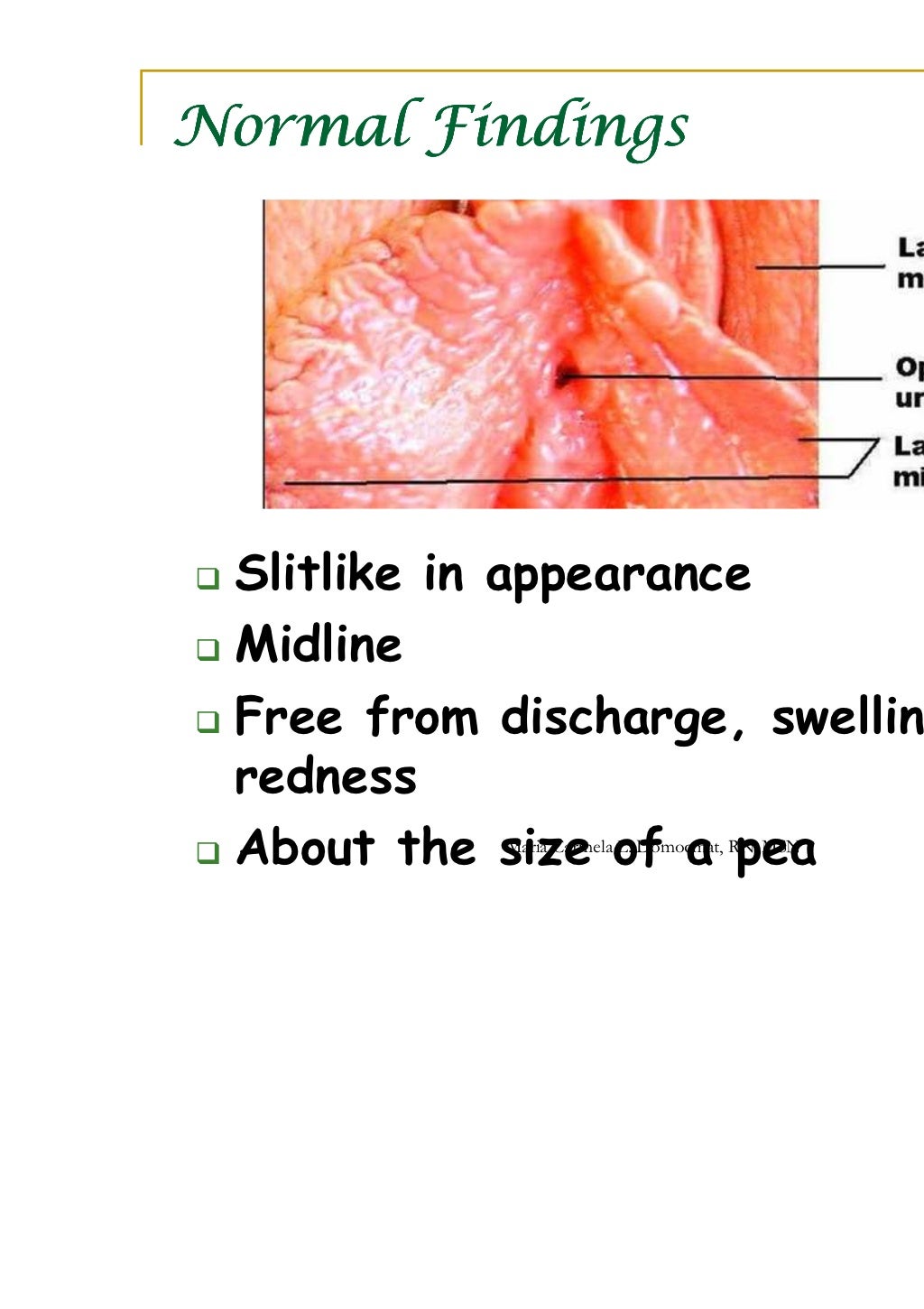 assessment of the female genitalia