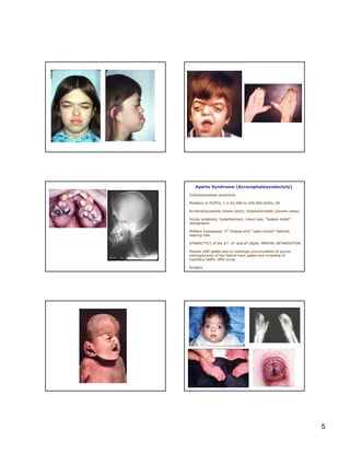 23 genetic disorders Slide 5