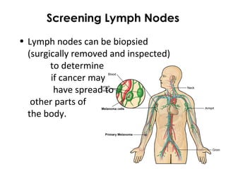 Screening Lymph Nodes
• Lymph nodes can be biopsied
(surgically removed and inspected)
to determine
if cancer may
have spread to
other parts of
the body.
 