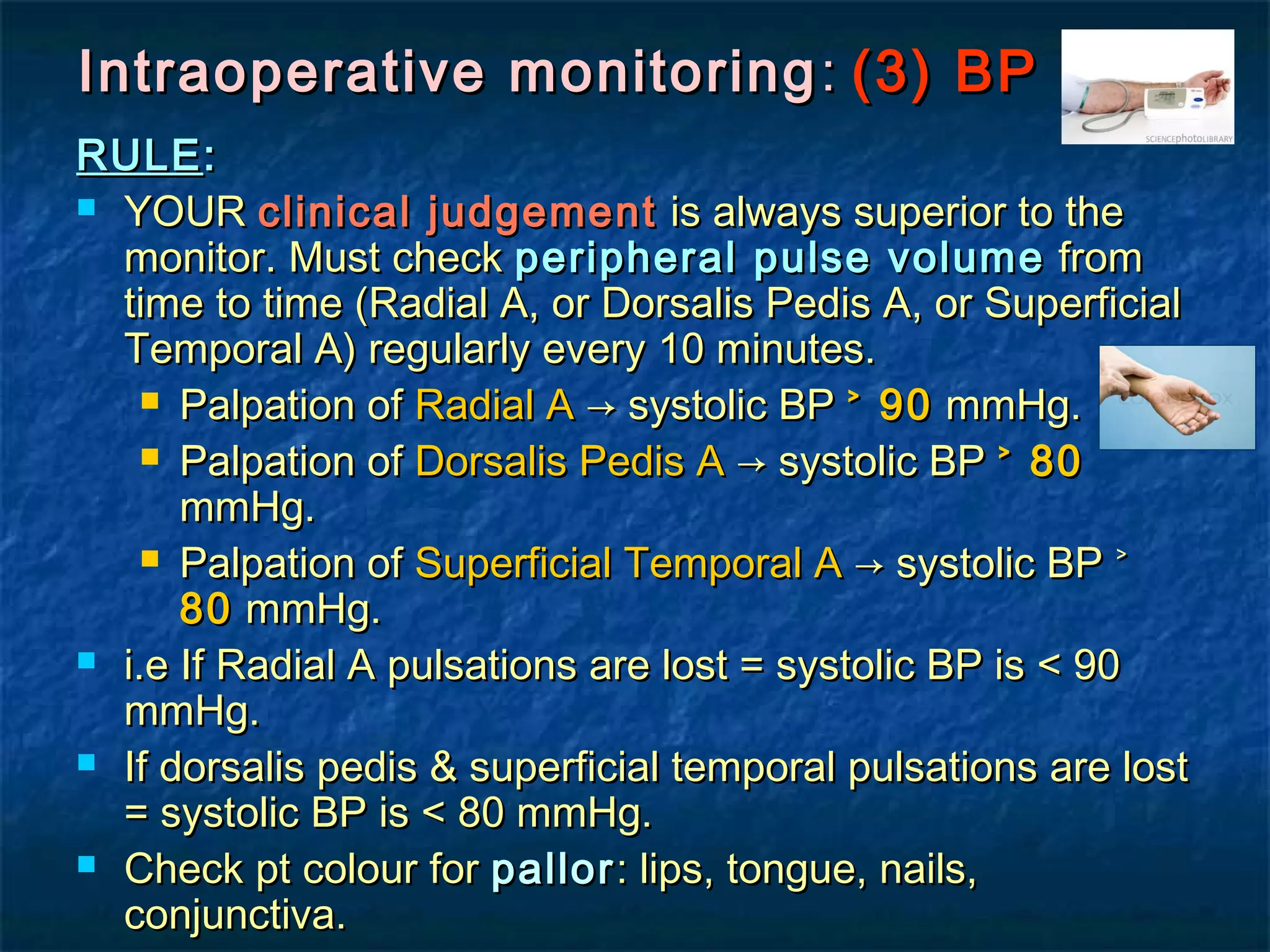 Intraoperative monitoringIntraoperative monitoring :: (3) BP(3) BP
RULERULE::
 YOURYOUR clinical judgementclinical judgement is always superior to theis always superior to the
monitor. Must checkmonitor. Must check peripheral pulse volumeperipheral pulse volume fromfrom
time to time (Radial A, or Dorsalis Pedis A, or Superficialtime to time (Radial A, or Dorsalis Pedis A, or Superficial
Temporal A) regularly every 10 minutes.Temporal A) regularly every 10 minutes.
 Palpation ofPalpation of Radial ARadial A → systolic BP→ systolic BP ˃ 90˃ 90 mmHg.mmHg.
 Palpation ofPalpation of Dorsalis Pedis ADorsalis Pedis A → systolic BP→ systolic BP ˃ 80˃ 80
mmHg.mmHg.
 Palpation ofPalpation of Superficial Temporal ASuperficial Temporal A → systolic BP ˃→ systolic BP ˃
8080 mmHg.mmHg.
 i.e If Radial A pulsations are lost = systolic BP is < 90i.e If Radial A pulsations are lost = systolic BP is < 90
mmHg.mmHg.
 If dorsalis pedis & superficial temporal pulsations are lostIf dorsalis pedis & superficial temporal pulsations are lost
= systolic BP is < 80 mmHg.= systolic BP is < 80 mmHg.
 Check pt colour forCheck pt colour for pallorpallor: lips, tongue, nails,: lips, tongue, nails,
conjunctiva.conjunctiva.
 