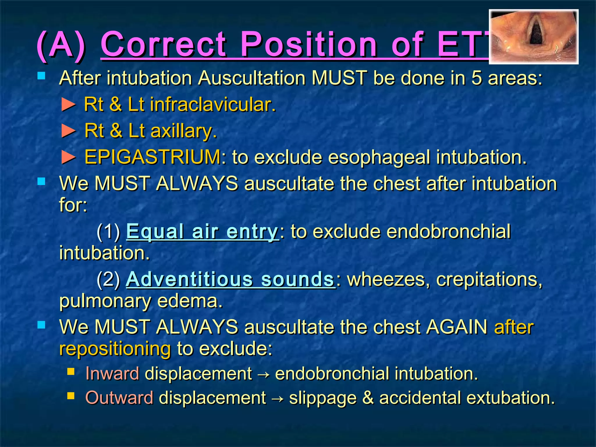 (A)(A) Correct Position of ETTCorrect Position of ETT
 After intubation Auscultation MUST be done in 5 areas:After intubation Auscultation MUST be done in 5 areas:
►► Rt & Lt infraclavicular.Rt & Lt infraclavicular.
►► Rt & Lt axillary.Rt & Lt axillary.
►► EPIGASTRIUMEPIGASTRIUM: to exclude esophageal intubation.: to exclude esophageal intubation.
 We MUST ALWAYS auscultate the chest after intubationWe MUST ALWAYS auscultate the chest after intubation
for:for:
(1)(1) Equal air entryEqual air entry: to exclude endobronchial: to exclude endobronchial
intubation.intubation.
(2)(2) Adventitious soundsAdventitious sounds : wheezes, crepitations,: wheezes, crepitations,
pulmonary edema.pulmonary edema.
 We MUST ALWAYS auscultate the chest AGAINWe MUST ALWAYS auscultate the chest AGAIN afterafter
repositioningrepositioning to exclude:to exclude:
 InwardInward displacement → endobronchial intubation.displacement → endobronchial intubation.
 OutwardOutward displacement → slippage & accidental extubation.displacement → slippage & accidental extubation.
 