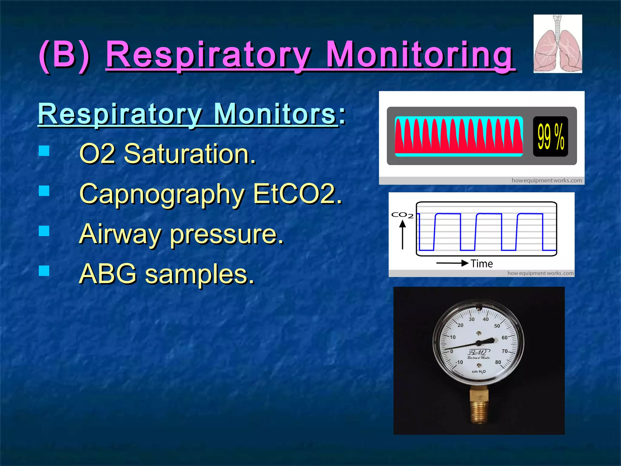 (B)(B) Respiratory MonitoringRespiratory Monitoring
Respiratory MonitorsRespiratory Monitors ::
 O2 Saturation.O2 Saturation.
 Capnography EtCO2.Capnography EtCO2.
 Airway pressure.Airway pressure.
 ABG samples.ABG samples.
 