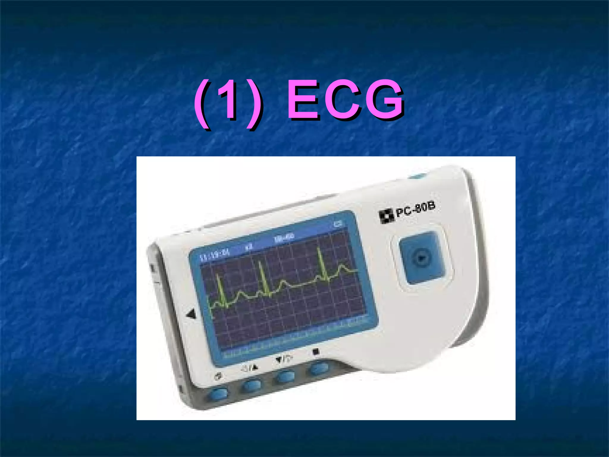 (1) ECG(1) ECG
 