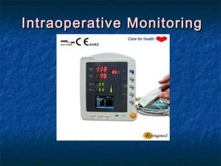 Intraoperative MonitoringIntraoperative Monitoring
 