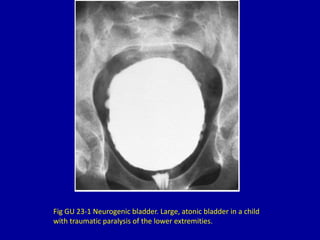 23 large urinary bladder | PPTX