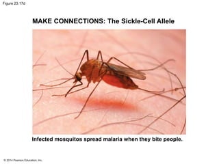 Figure 23.17d 
MAKE CONNECTIONS: The Sickle-Cell Allele 
Infected mosquitos spread malaria when they bite people. 
© 2014 Pearson Education, Inc. 
 