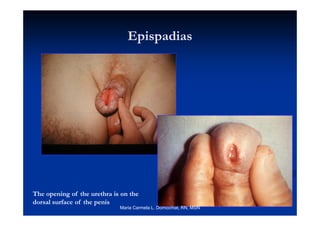 pediatric genital male 
