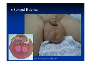 pediatric genital male assessment of the male genitalia | PPT