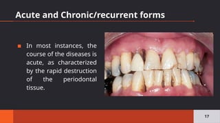Acute and Chronic/recurrent forms
▪ In most instances, the
course of the diseases is
acute, as characterized
by the rapid destruction
of the periodontal
tissue.
17
 