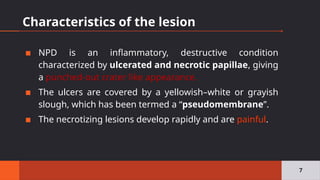 Characteristics of the lesion
▪ NPD is an inflammatory, destructive condition
characterized by ulcerated and necrotic papillae, giving
a punched‐out crater like appearance.
▪ The ulcers are covered by a yellowish–white or grayish
slough, which has been termed a “pseudomembrane”.
▪ The necrotizing lesions develop rapidly and are painful.
7
 