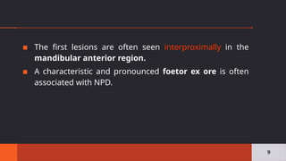 ▪ The first lesions are often seen interproximally in the
mandibular anterior region.
▪ A characteristic and pronounced foetor ex ore is often
associated with NPD.
9
 