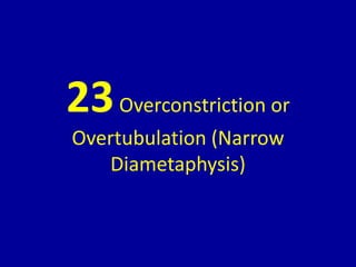 23Overconstriction or
Overtubulation (Narrow
Diametaphysis)
 