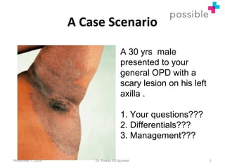A Case Scenario
A 30 yrs male
presented to your
general OPD with a
scary lesion on his left
axilla .
1. Your questions???
2. Differentials???
3. Management???
November 7, 2016 1Dr. Pawan KB Agrawal
 