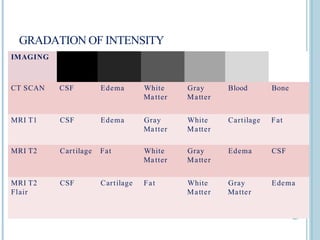 GRADATION OF INTENSITY
IMAGING
CT SCAN CSF Edema White
Matter
Gray
Matter
Blood Bone
MRI T1 CSF Edema Gray
Matter
White
Matter
Cartilage Fat
MRI T2 Cartilage Fat White
Matter
Gray
Matter
Edema CSF
MRI T2
Flair
CSF Cartilage Fat White
Matter
Gray
Matter
Edema
 
